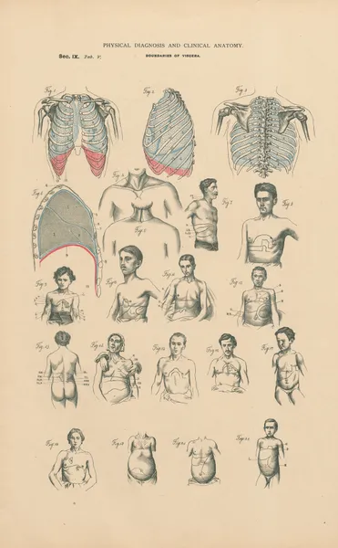 Physical diagnosis. Boundaries of sounds av Jean Allard Jeancon