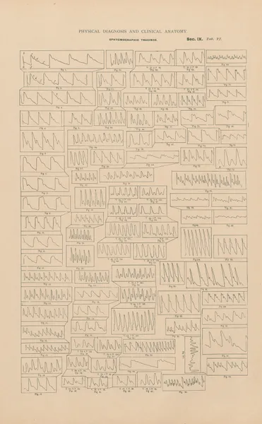 Sphygmographic tracings av Jean Allard Jeancon
