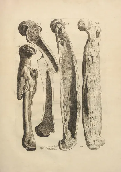 Nouveau recueil d’ostéologie et de myologie; dessiné d’après nature Pl.25 av Jacques Gamelin