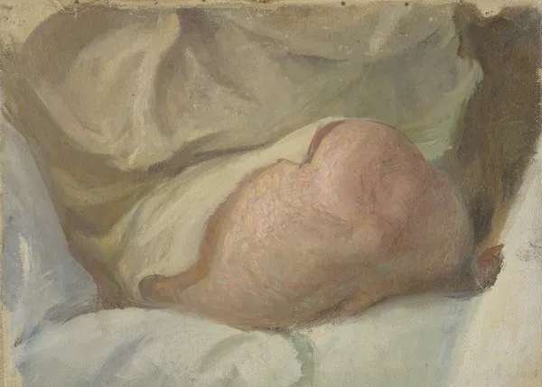 Study for Gustaf Fröding’s Knee av Richard Bergh